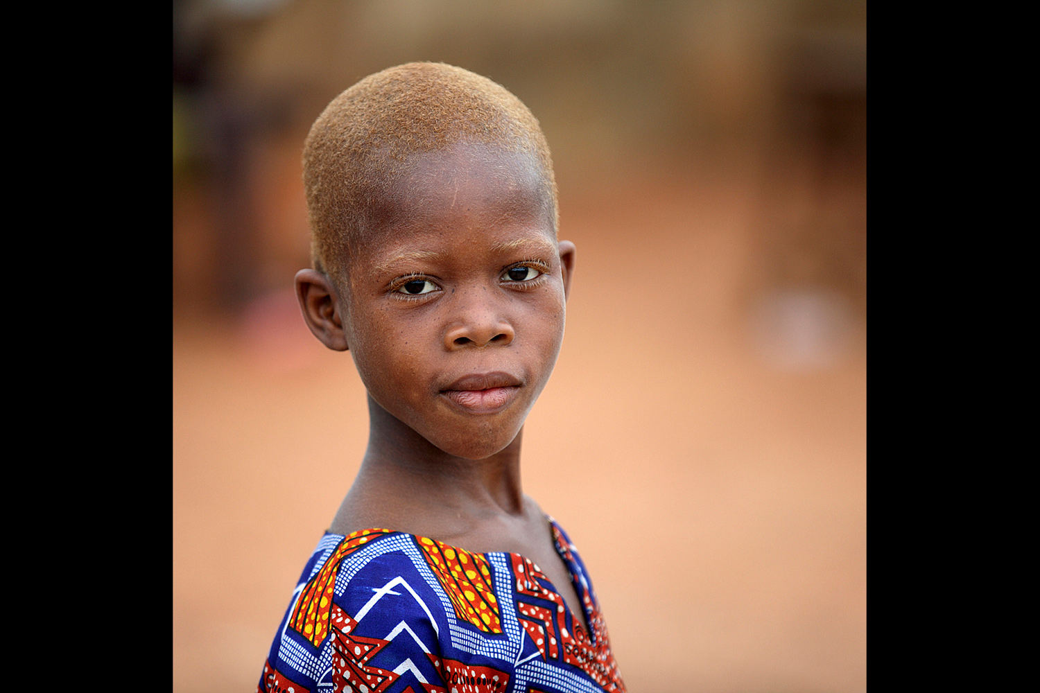 Portrait d’un jeune enfant roux au Bénin en 2011